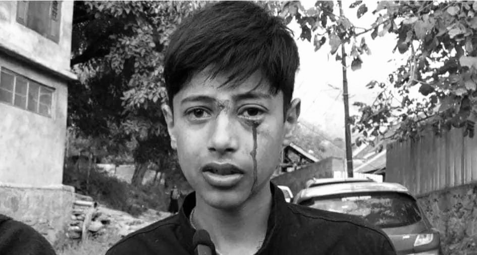 For Not Wearing A Khan Dress, Student Allegedly Beaten by Teacher, Police Register FIR