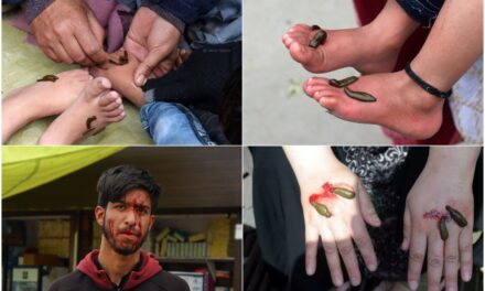Kashmir On ‘Navroz’ hundreds let leeches suck their blood in hope of getting rid of long-time aliments