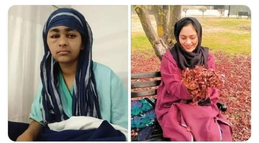 University girl Sadaf Ayoub loses battle with life