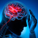 Stroke cases increasing globally, air pollution, high temperatures driving numbers: Lancet Study