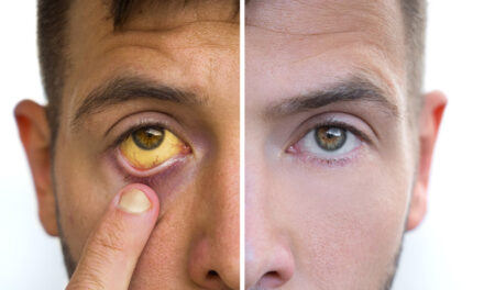 27 test positive for jaundice in Anantnag village