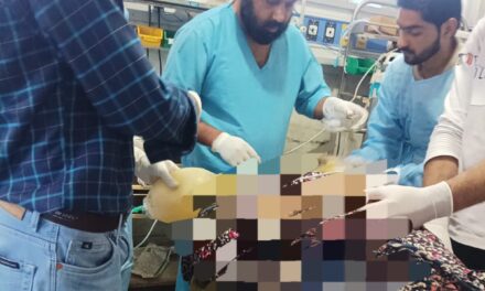 50-Year-Old Woman Critically Injured in Kulgam Road Accident