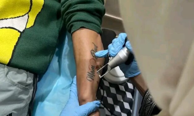 Free Tattoo Removal Camp by Ehsaas Foundation and Revive Aesthetics Concludes Successfully in Srinagar